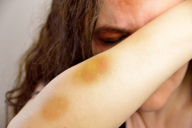 Segurança - violência doméstica - mulher - mulheres - Lei Maria da Penha