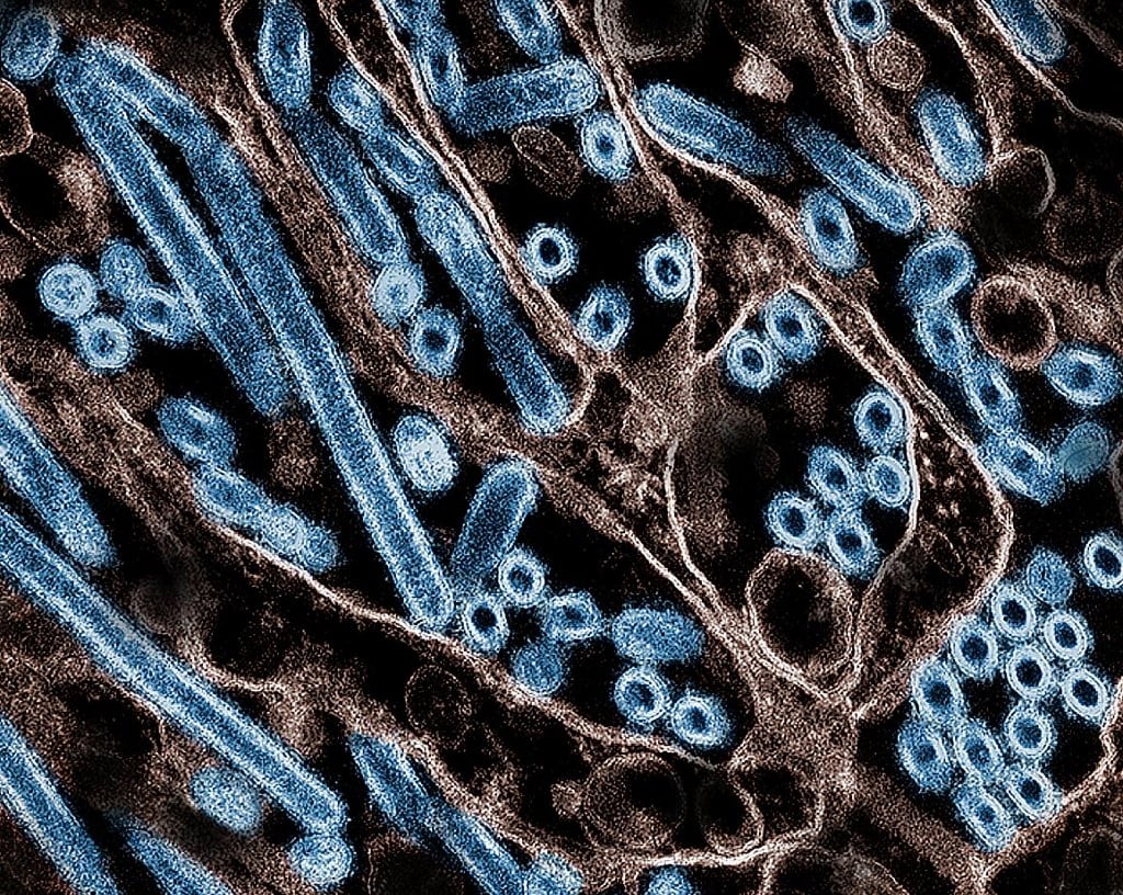 EUA registram a 1ª morte humana por gripe aviária – Saúde – CartaCapital