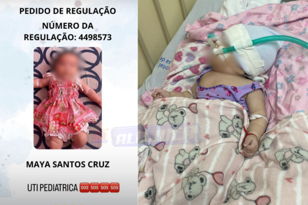 bebê de 2 meses com bronquiolite precisa ser transferida para UTI pediátrica