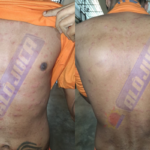 após casos de catapora em internos na Cadeia Pública, SEAP decide suspender visitar neste sábado (23)