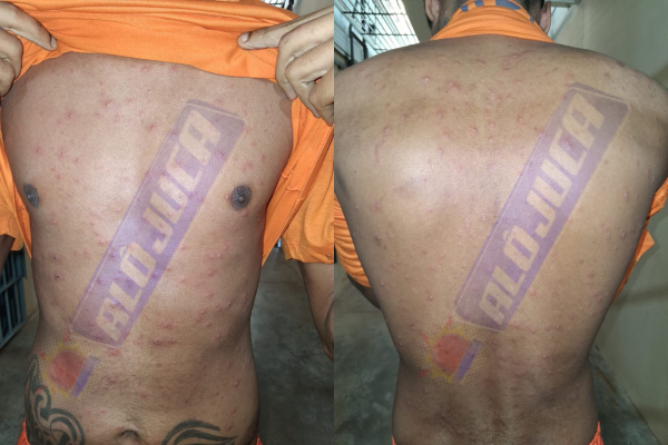 após casos de catapora em internos na Cadeia Pública, SEAP decide suspender visitar neste sábado (23)