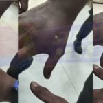 jovem é baleado pelo “tribunal do crime” após roubo em Valéria e se torna alerta para comunidade