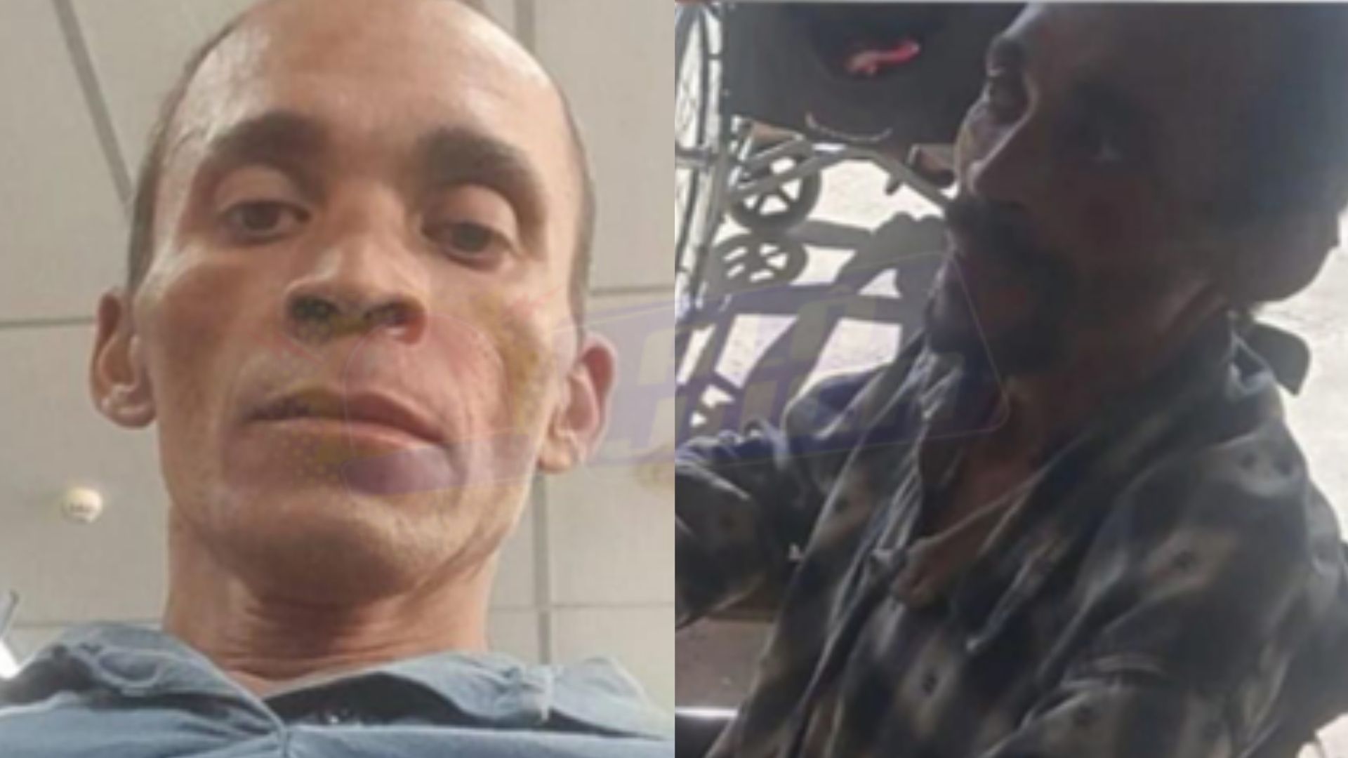 homem em tratamento contra câncer some após surto psicótico em Salvador