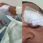 motociclista por aplicativo é vítima de cerol em Periperi e quase perde o dedo