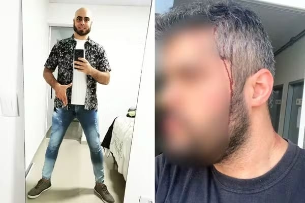 Sobrinho de Bolsonaro vai a júri popular por tentativa de feminicídio – CartaCapital