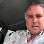 Pré-candidato à Presidência do Peru sai ileso de ataque a tiros – CartaCapital