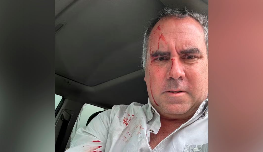 Pré-candidato à Presidência do Peru sai ileso de ataque a tiros – CartaCapital